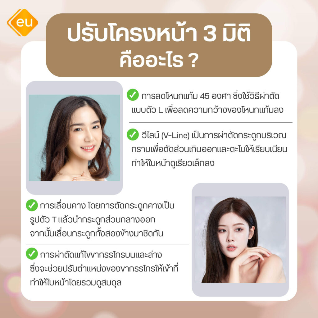 ปรับโครงหน้า 3 มิติ