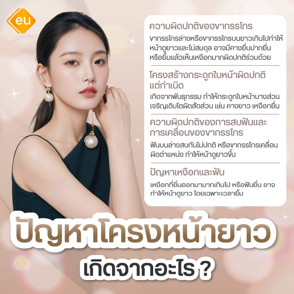 ปัญหาโครงหน้ายาว เกิดจาก