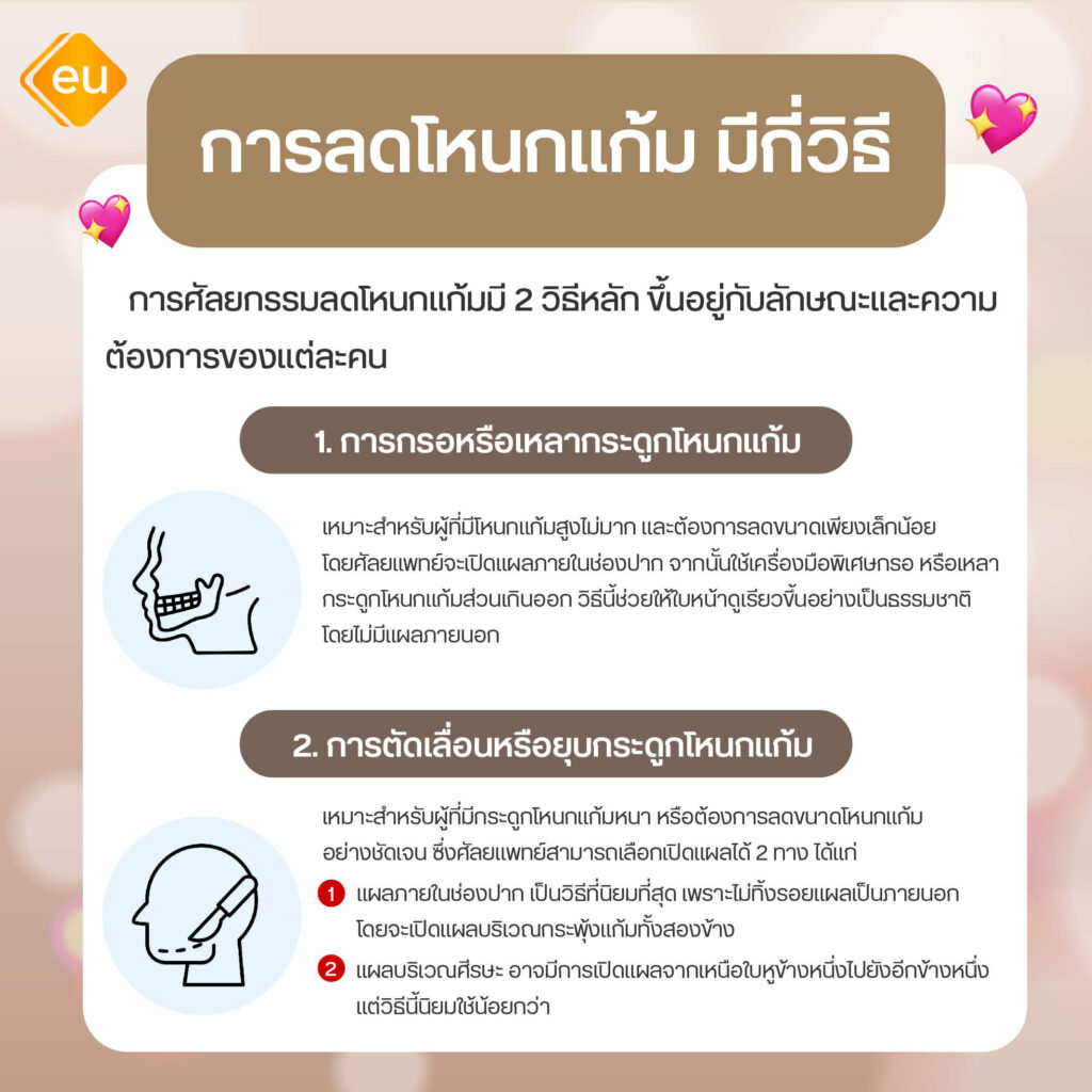 ศัลยกรรมลดโหนกแก้ม มีกี่วิธี