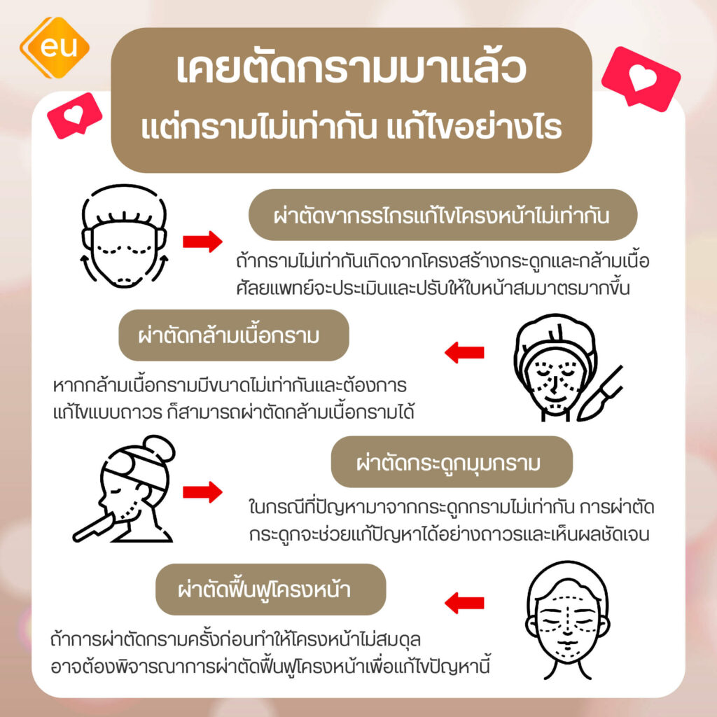 เคยศัลยกรรมผ่าตัดกราม แล้วหน้าไม่เท่ากันแก้อย่างไร