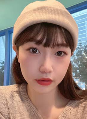 bna เคสรีวิว ปากยื่น คางหลุบ ยิ้มเห็นเหงือก