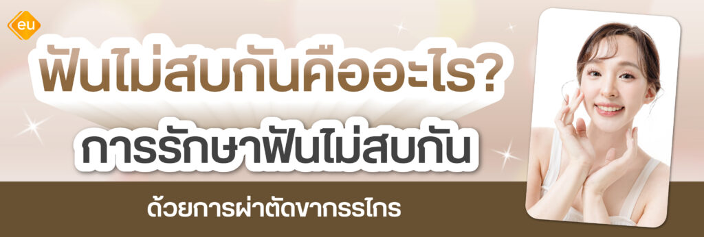 ฟันไม่สบกัน เป็นอย่างไร รักษาด้วยวิธีไหนดี