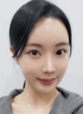 รีวิวเคสผ่าตัดขากรรไกรกับคุณหมอคิมจองยุน