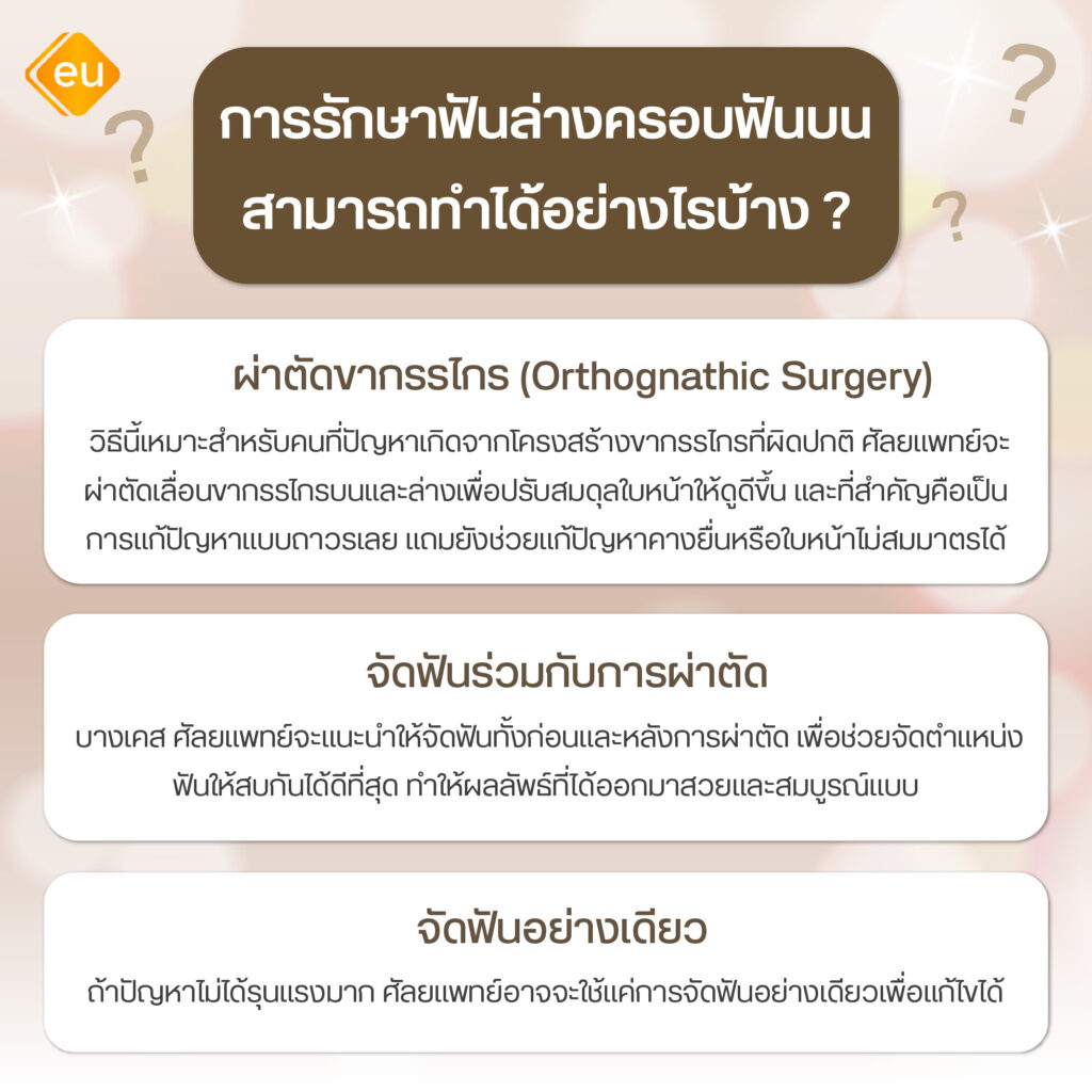 วิธีการรักษาปัญหาฟันล่างครอบฟันบน