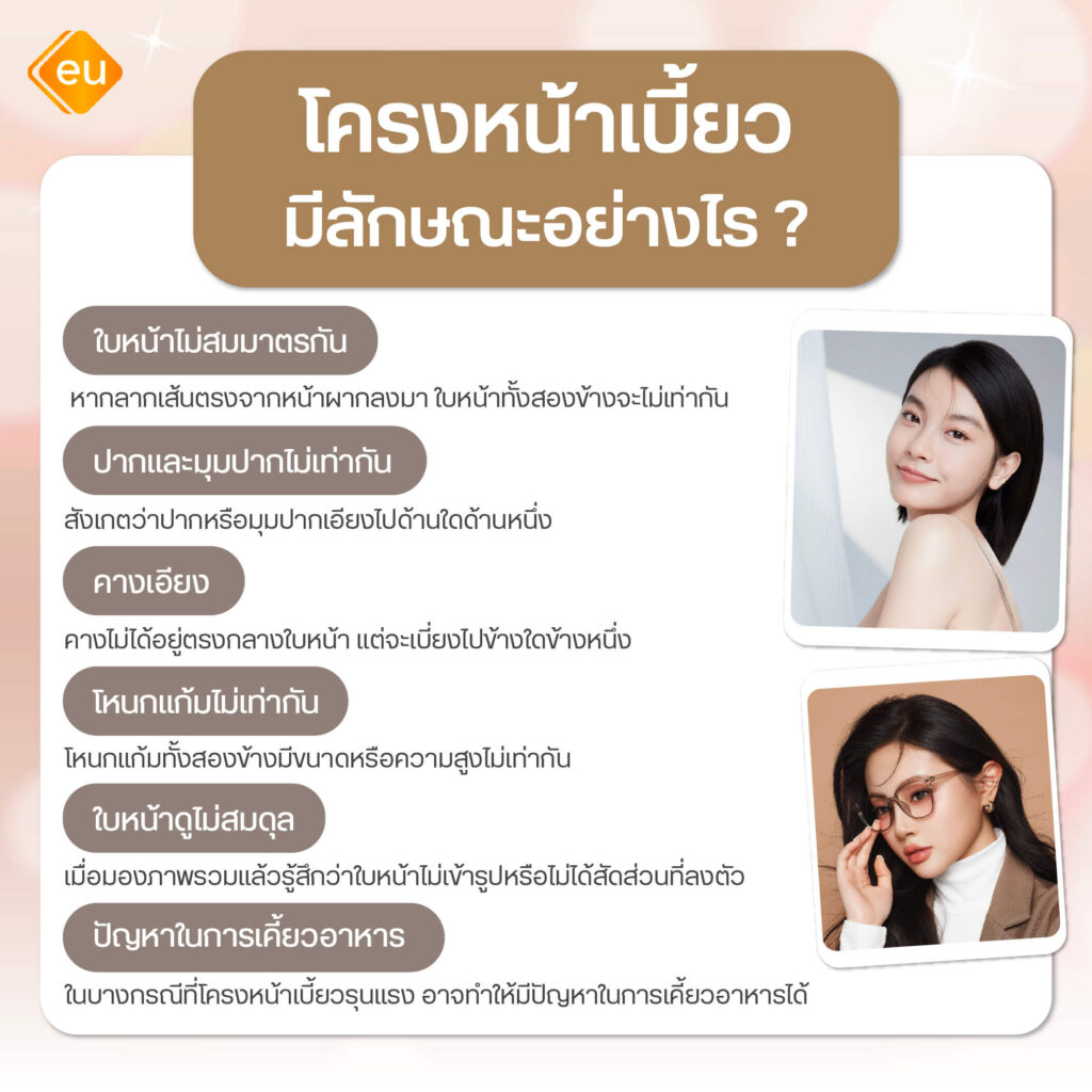 โครงหน้าเบี้ยว มีลักษณะเป็นอย่างไร