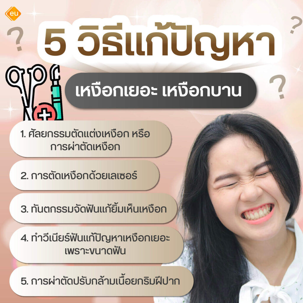 5 วิธีแก้ปัญหาเหงือกเยอะ เหงือกบาน