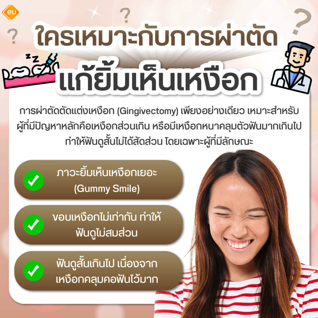 การผ่าตัดแก้ปัญหายิ้มเห็นเหงือกเหมาะกับใคร