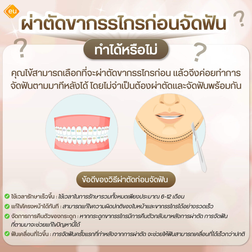 ผ่าตัดขากรรไกรก่อนจัดฟัน ทำได้หรือไม่