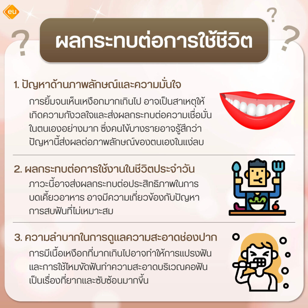 ยิ้มเห็นเหงือกส่งผลกระทบอะไรบ้าง