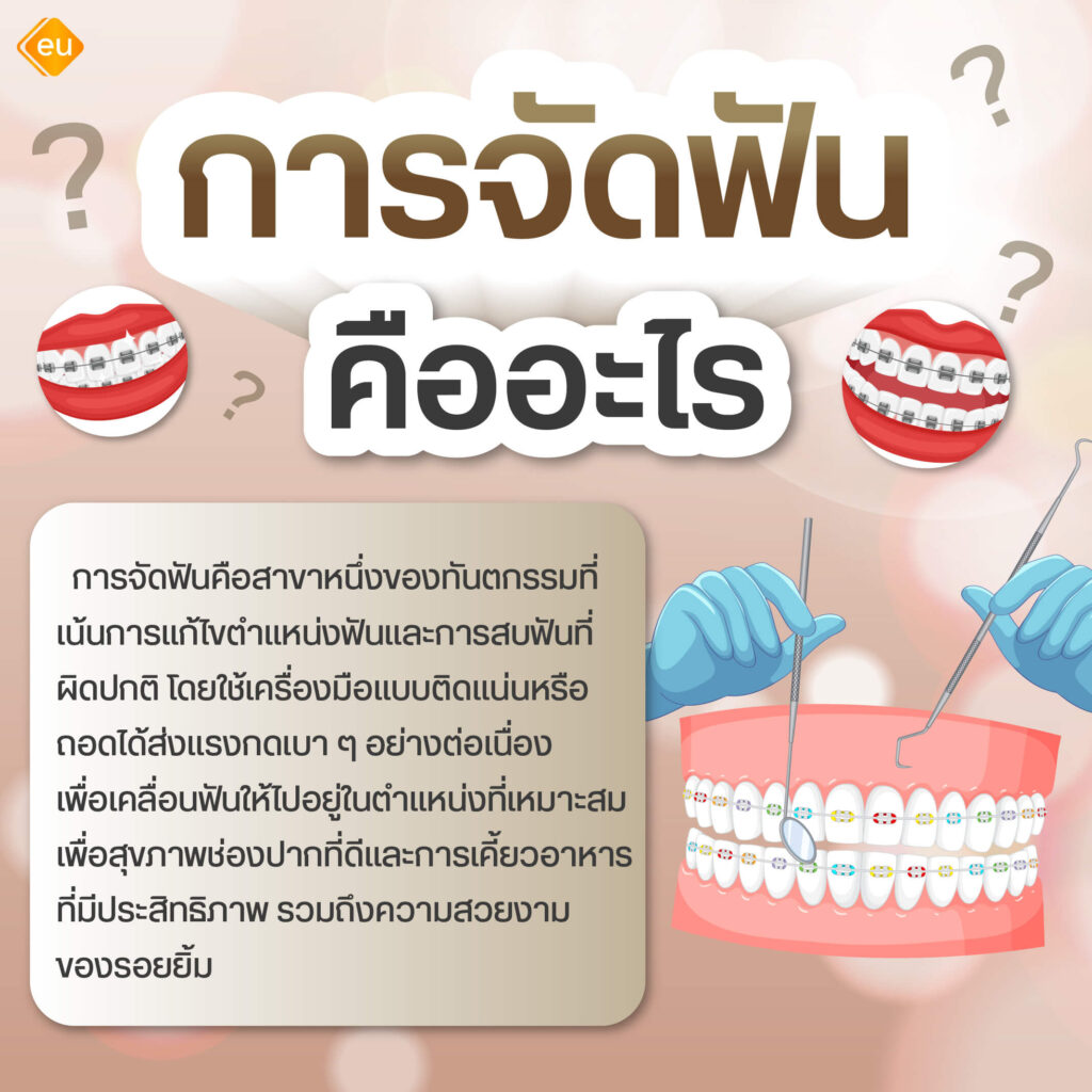 การจัดฟันคืออะไร