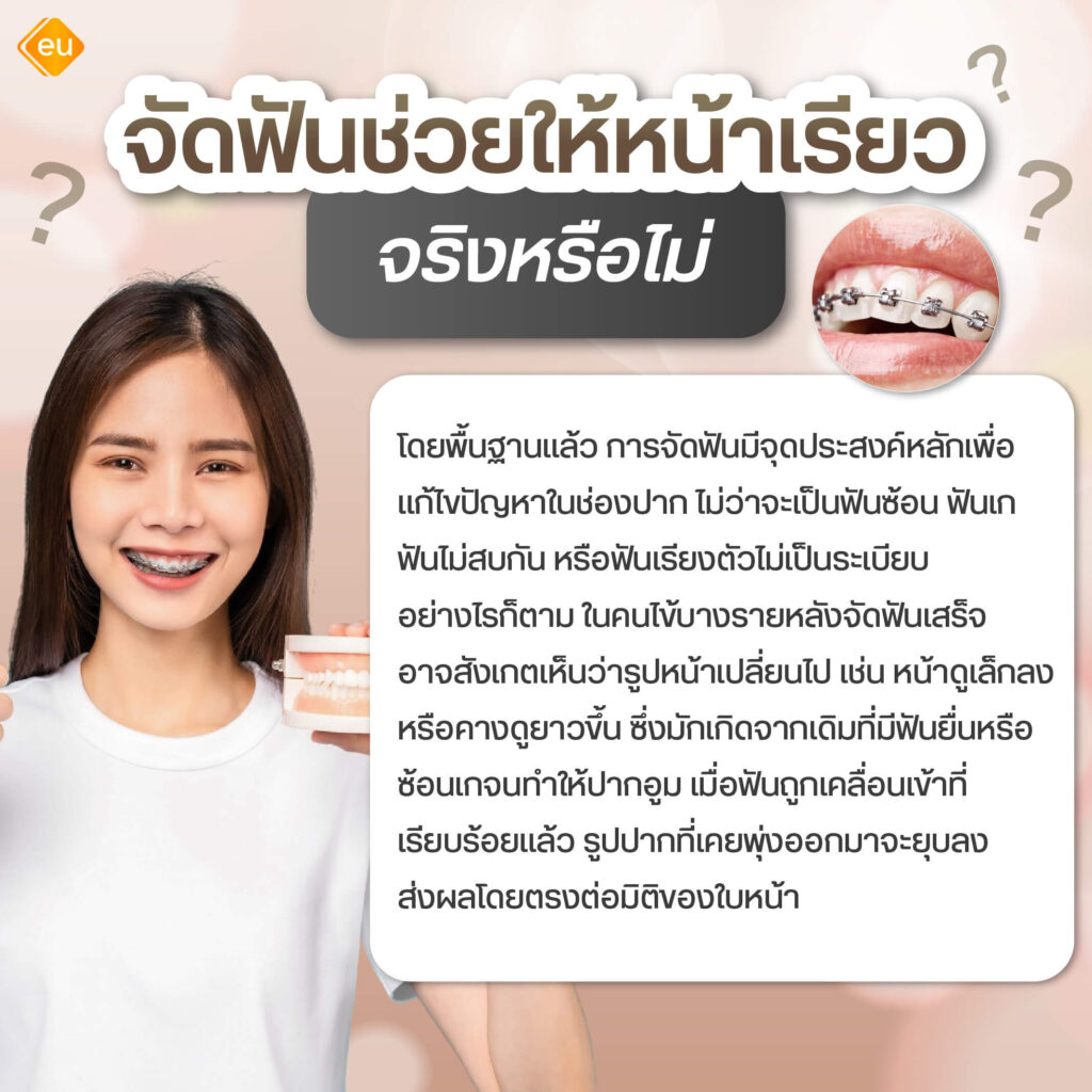 จัดฟันช่วยให้หน้าเรียวจริงไหม
