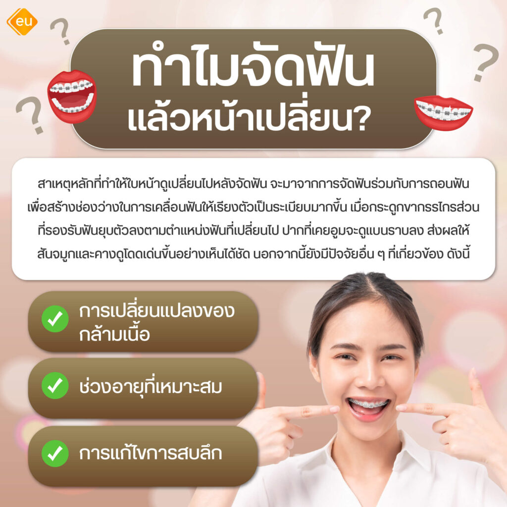 ทำไมจัดฟันแล้วหน้าเปลี่ยน