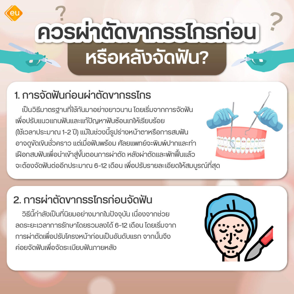 ผ่าตัดขากรรไกร ก่อน หรือ หลังจัดฟัน เลือกแบบไหนดี
