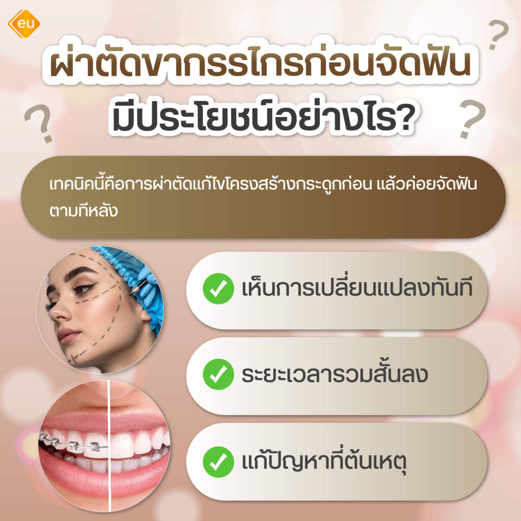 ผ่าตัดขากรรไกร ก่อนจัดฟัน ดีอย่างไร