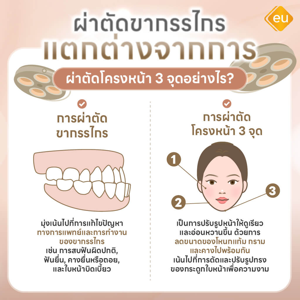 การผ่าตัดขากรรไกร ต่างจากการผ่าตัดโครงหน้าอย่างไร