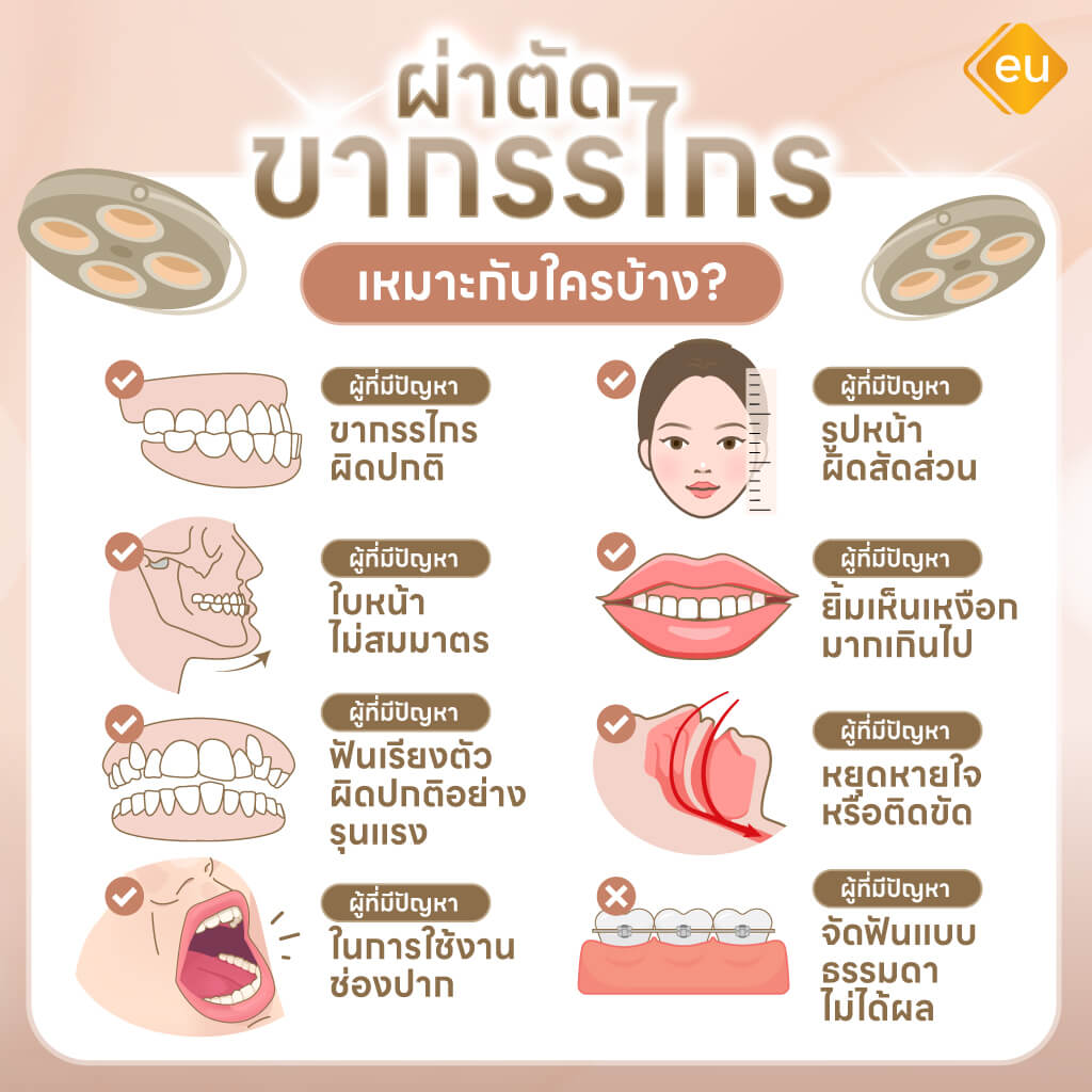 การผ่าตัดขากรรไกรเหมาะกับคนที่มีปัญหาใบหน้าแบบไหน