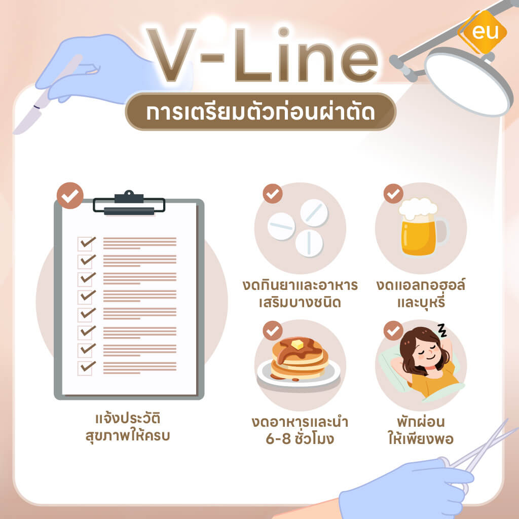 ก่อนเตรียมตัวก่อนศัลยกรรมวีไลน์