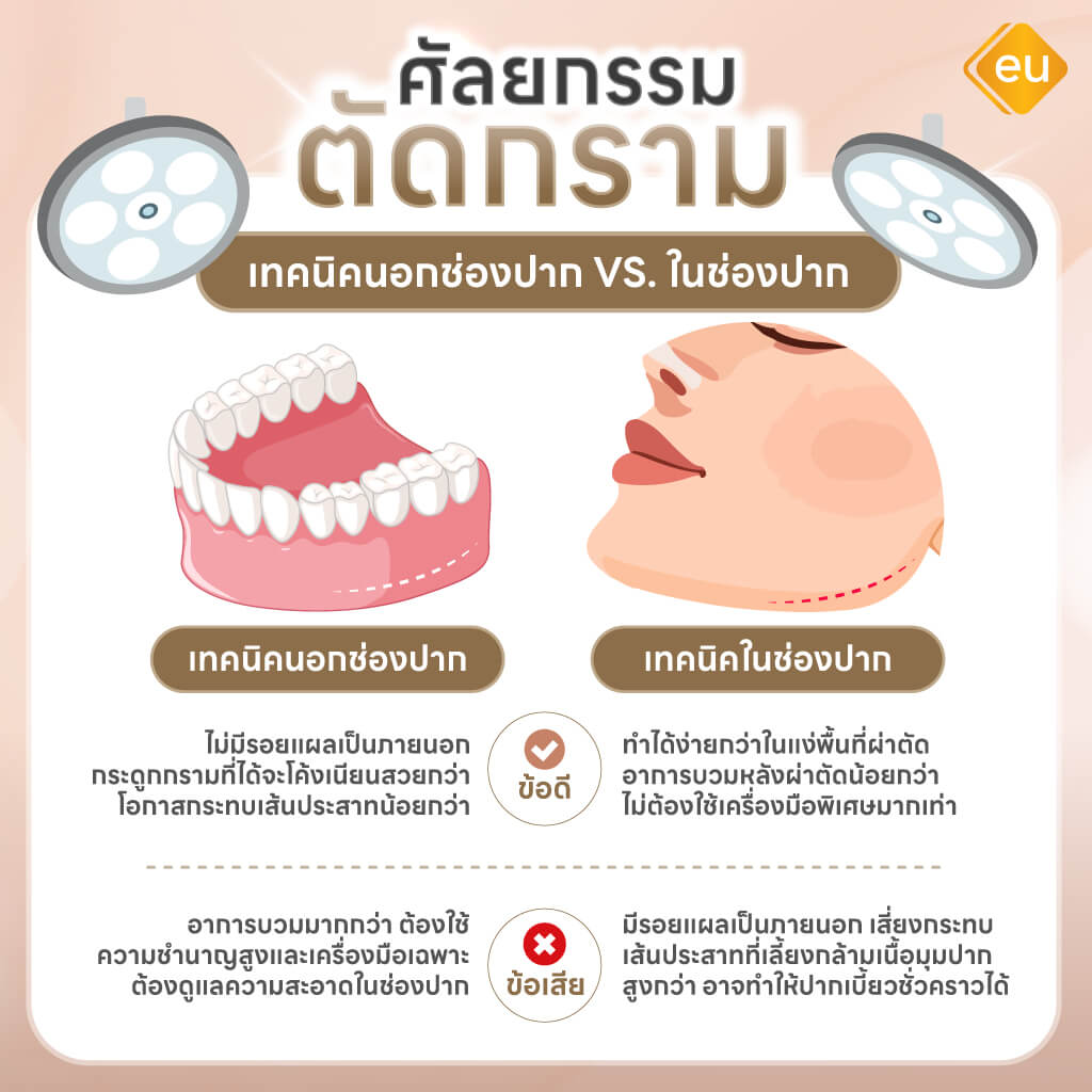ผ่าตัดกราม แผลในช่องปาก กับ แผลนอกช่องปาก
