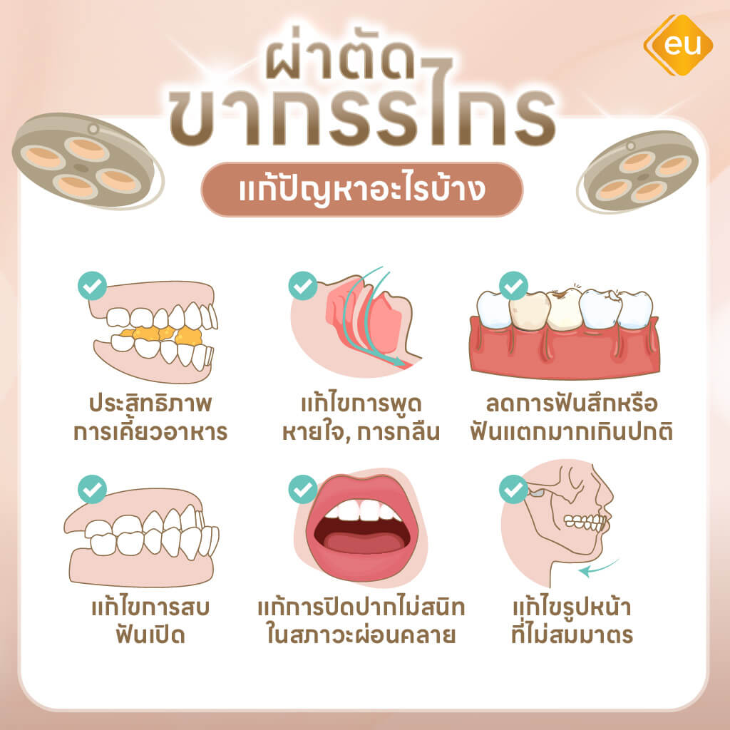 ผ่าตัดขากรรไกร ช่วยแก้ไขปัญหาเรื่องอะไรบ้าง