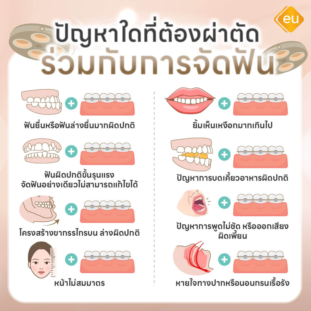 ลักษณะของปัญหาที่ควรผ่าขากรรไกร ร่วมกับ จัดฟัน