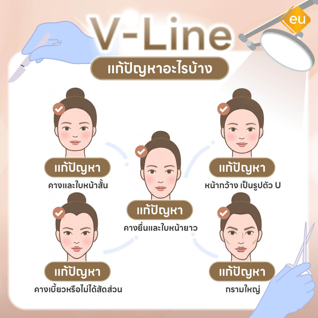 วีไลน์ แก้ปัญหาโครงหน้าแบบไหน
