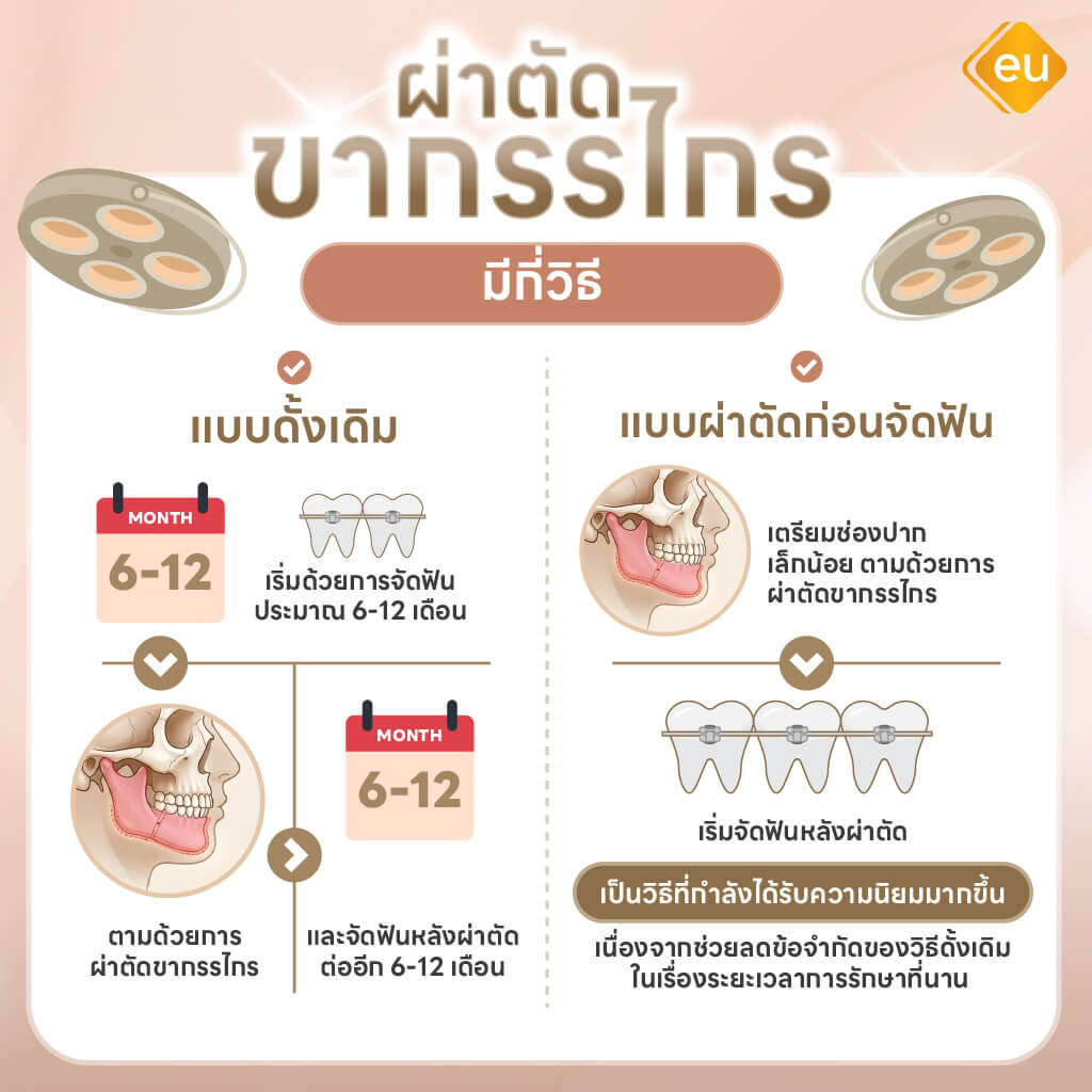 เทคนิคผ่าตัดขากรรไกร มีกี่วิธี