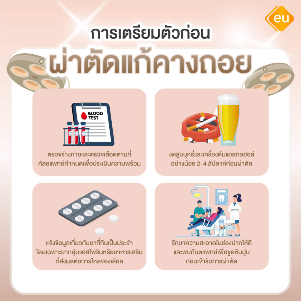 การเตรียมตัวก่อนผ่าตัดแก้คางถอย
