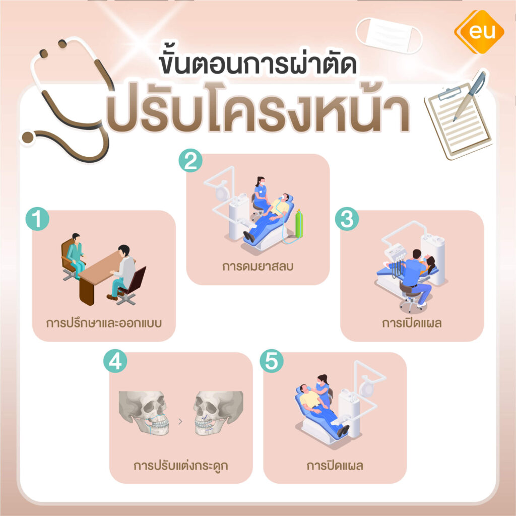 ขั้นตอนการศัลยกรรมปรับโครงหน้าผู้ชาย