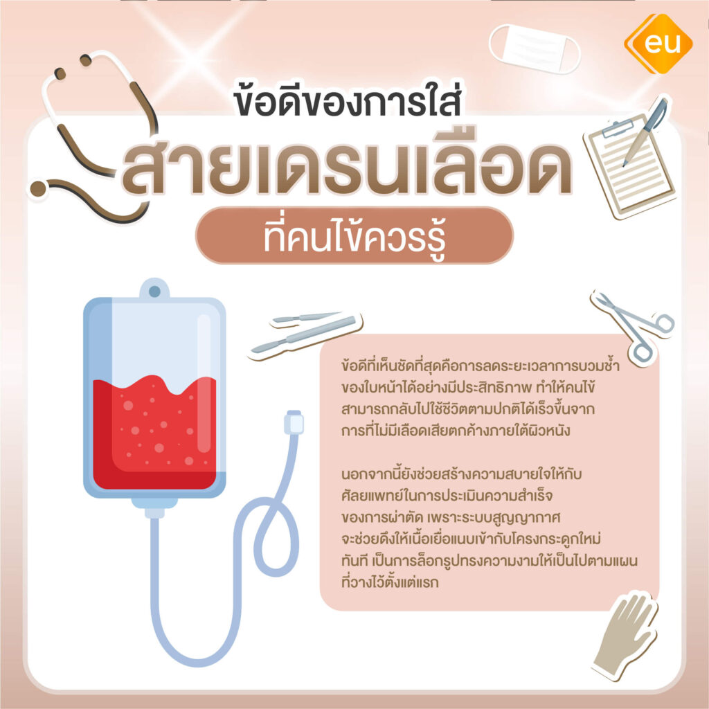 ข้อดีของ สายเดรนเลือด