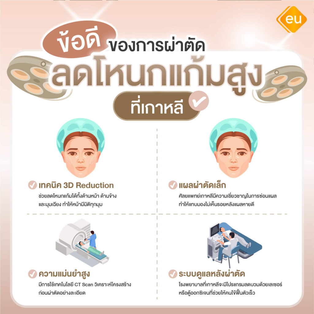ข้อดีของการผ่าตัดลดโหนกแก้มสูง