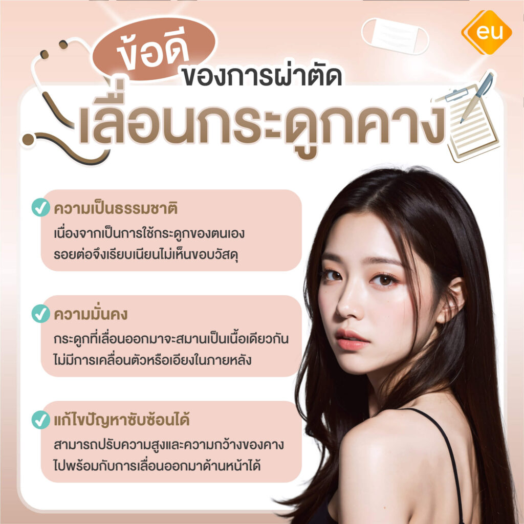 ข้อดีของการเลื่อนคางแก้ปัญหาคางถอย