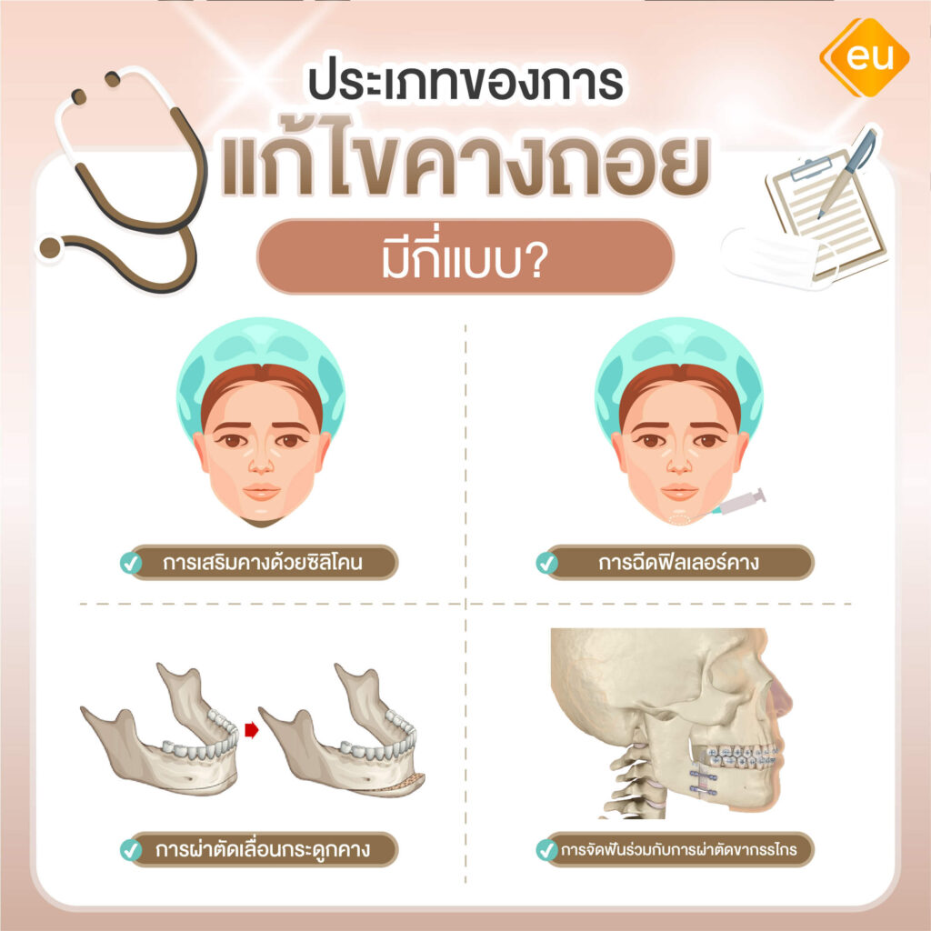 คางถอยมีกี่แบบ