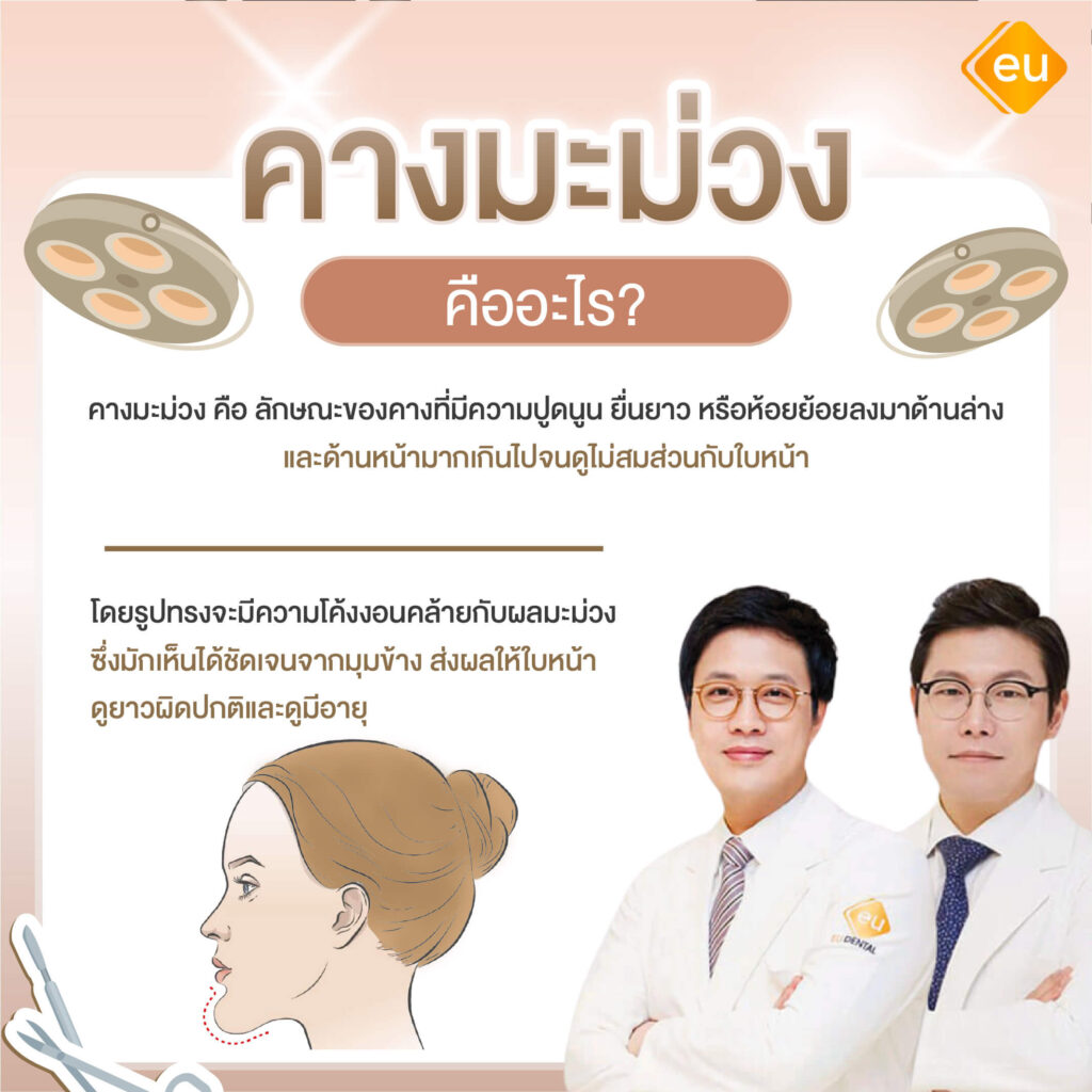 คางมะม่วง คืออะไร