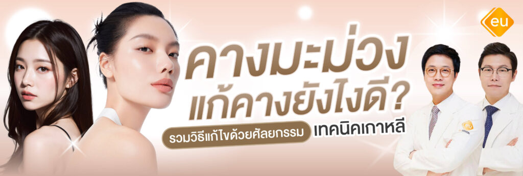 คางมะม่วง แก้ด้วยวิธีไหนดี