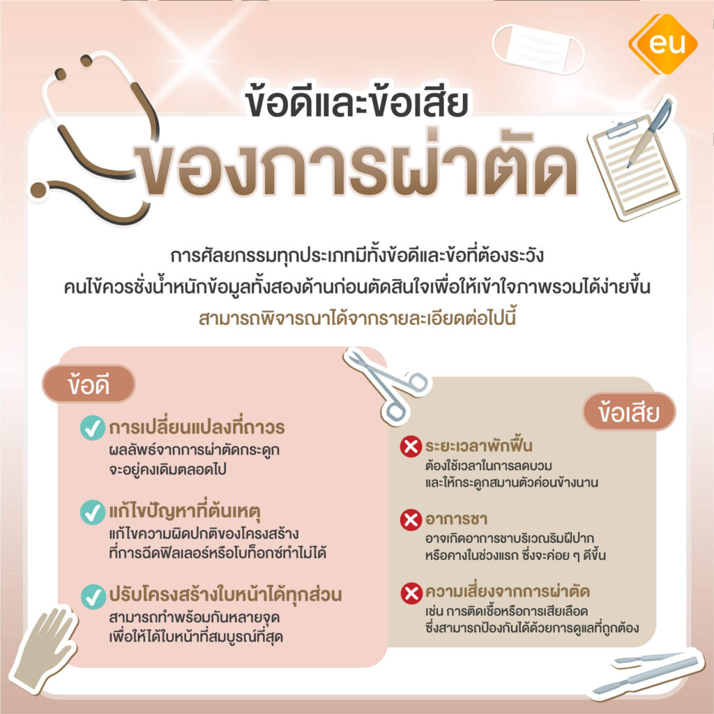 ช้อดีและข้อเสียของแต่ละแบบ