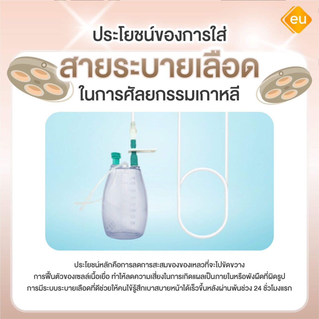 ประโยชน์ของ สายเดรนเลือด