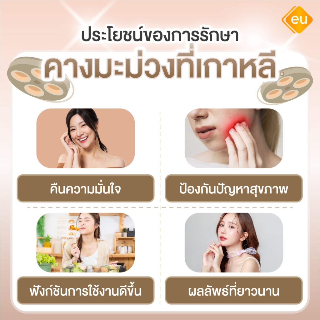 ประโยชน์ของการรักษาคางมะม่วง