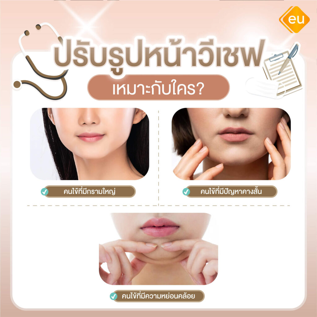 ปรับรูปหน้าวิเชฟ เหมาะกับคนที่มีรูปหน้าแบบไหน