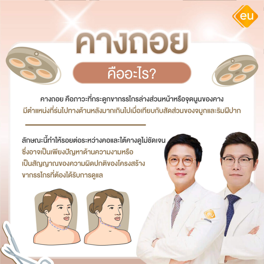 ลักษณะคางถอย คืออะไร