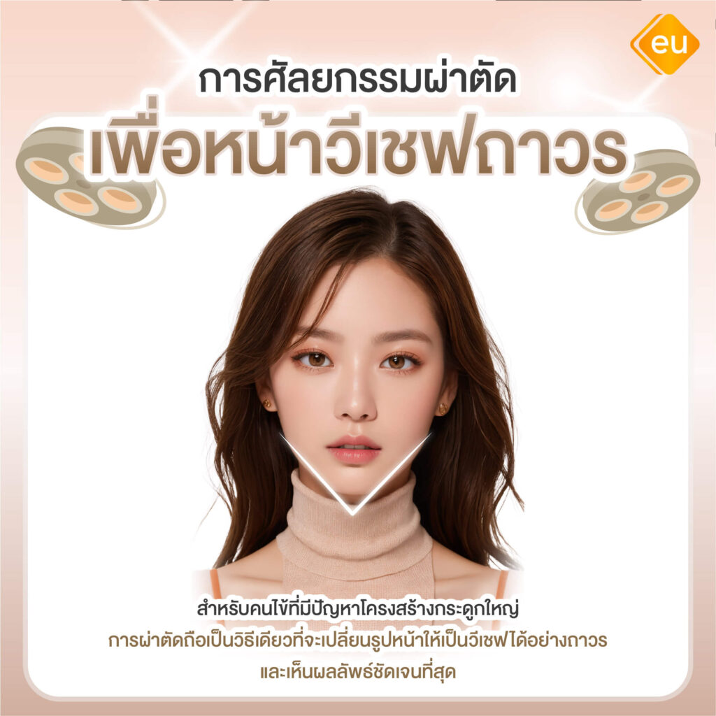 ศัลยกรรมผ่าตัดปรับโครงหน้าวีเชฟ