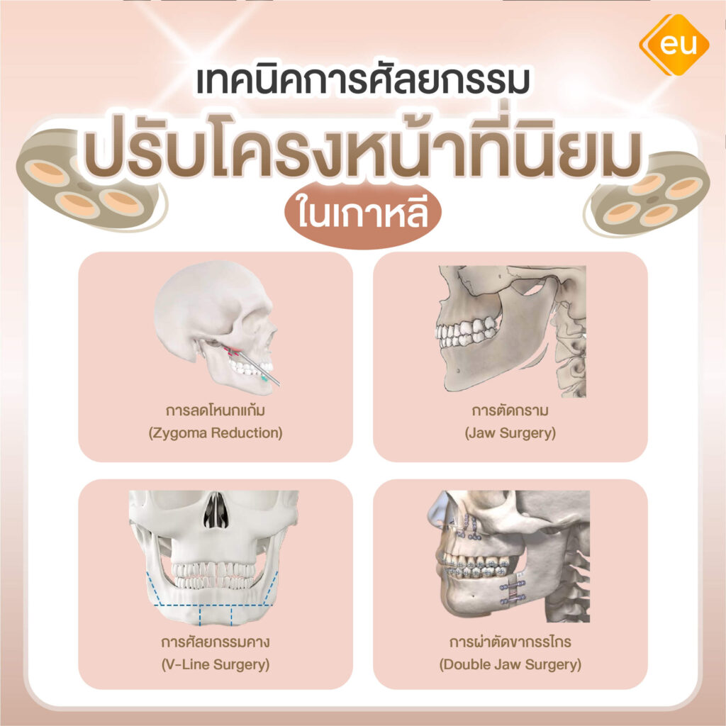 เทคนิคการศัลยกรรมปรับโครงหน้าที่เกาหลี