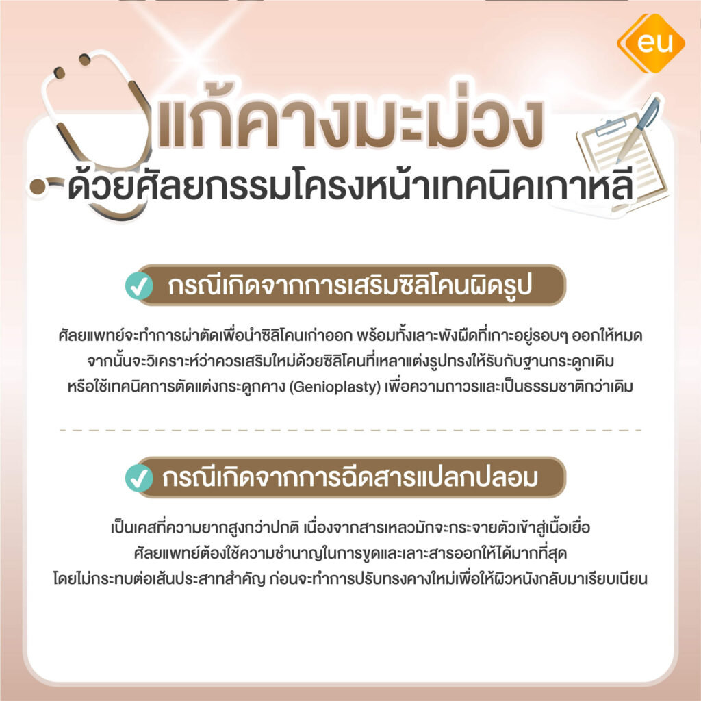 เทคนิคการแก้คางมะม่วง ด้วยการศัลยกรรม