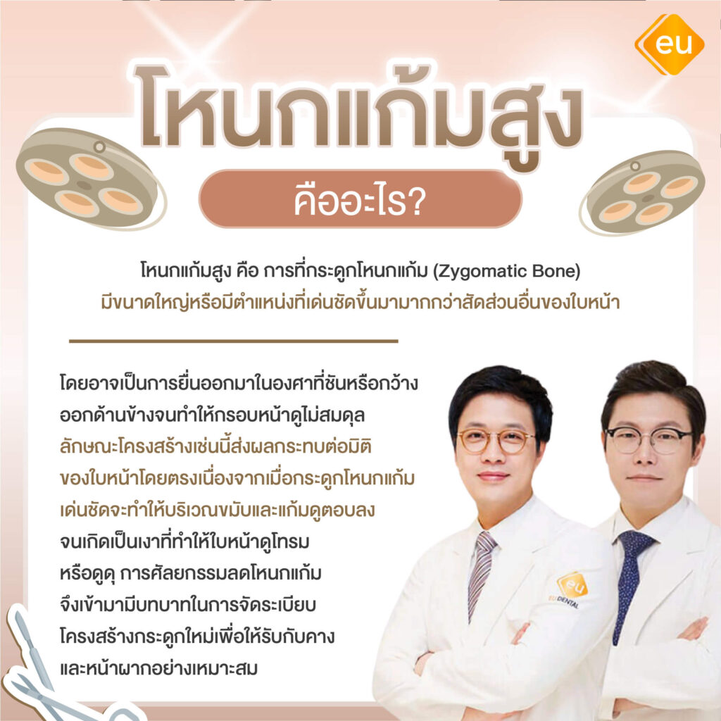 โหนกแก้มสูง คืออะไร
